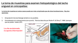 15a - Opciones de toma de muestras en onicopatías